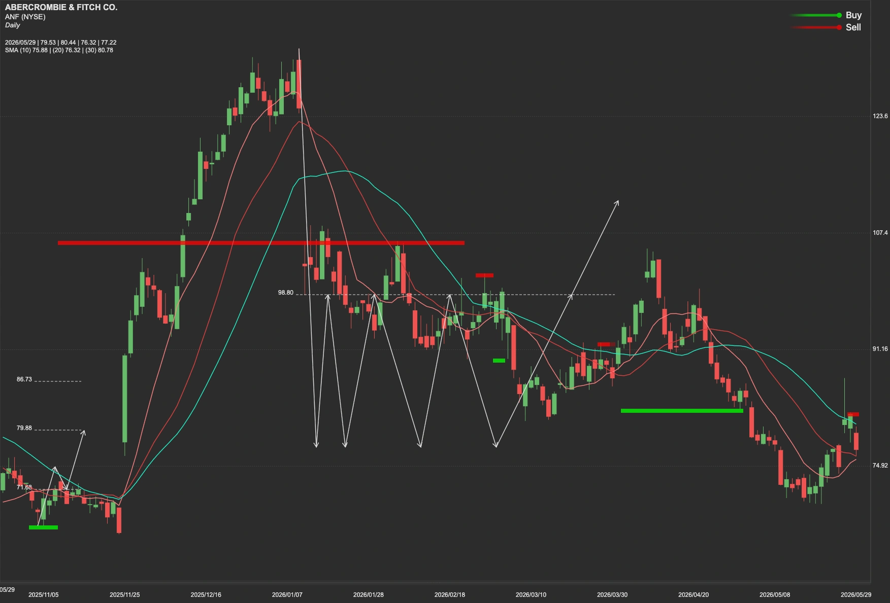 Abercrombie & Fitch stock AI analysis chart